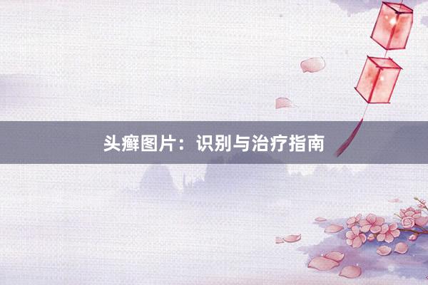 头癣图片：识别与治疗指南